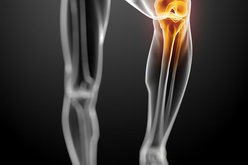 Aké zložky sú dôležité pre naše kĺby?